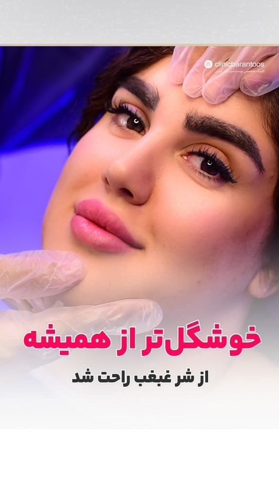 آیا می‌شود با کاهش وزن غبغب را کوچک کرد یا حتماً باید ساکشن غبغب انجام داد؟